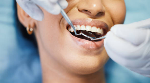 Best Knocked-Out Tooth (Avulsed Tooth) Treatment in Ness City, KS