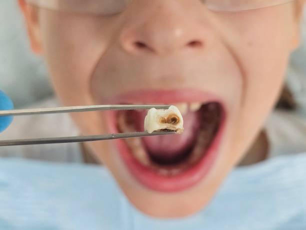Best Emergency Orthodontic Repairs in Ness City, KS